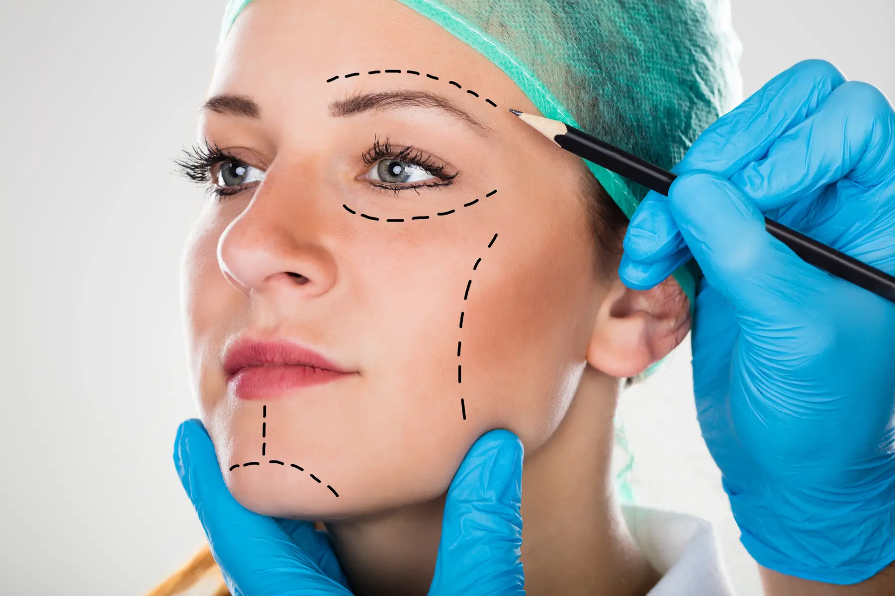 Surgeon marking woman's face for cosmetic procedure planning.